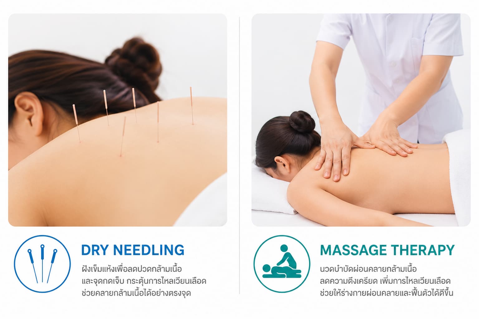 Dry Needling กับการนวดต่างกันอย่างไร — โรงพยาบาลธนบุรีตรัง