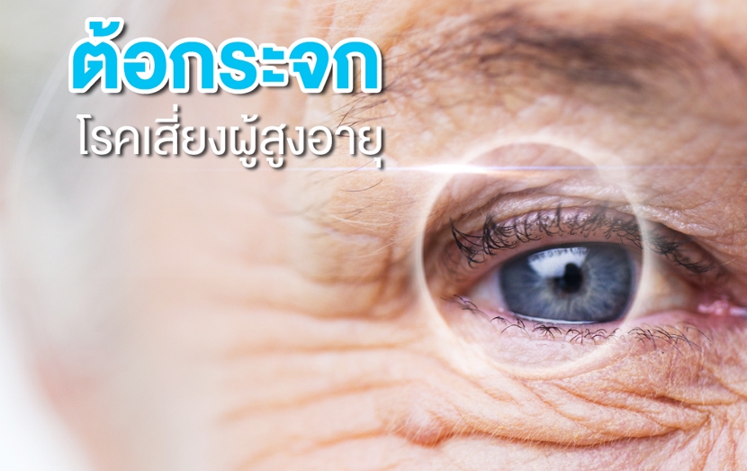 ต้อกระจกโรคเสี่ยงผู้สูงอายุ 1